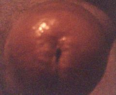 ////////////////////