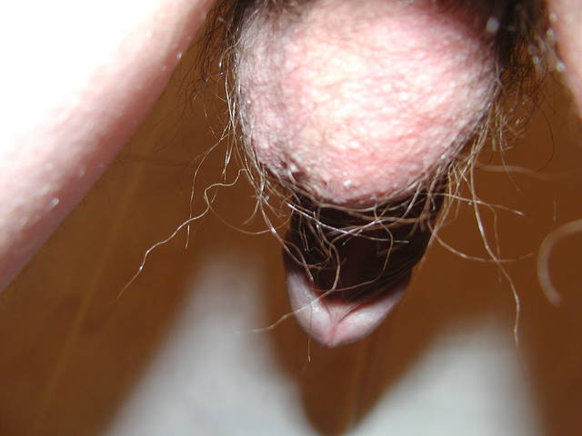 jajeczko od tylca po raz drugi - onan_real