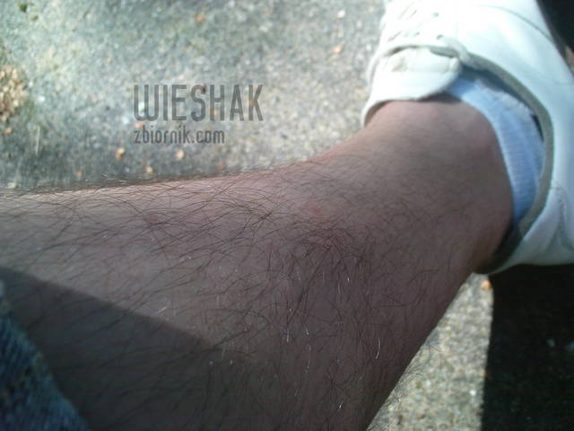 wieshak