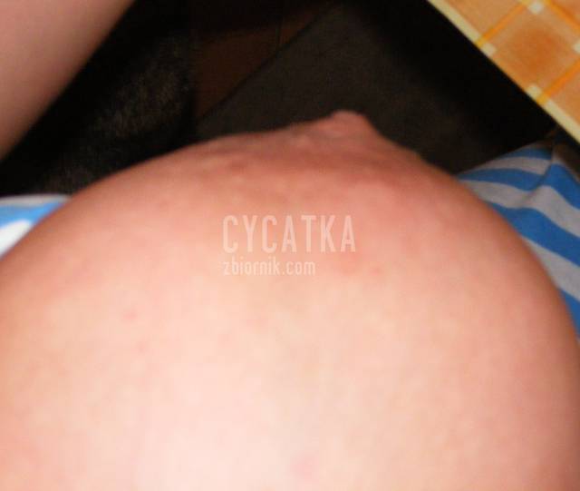 cycatka