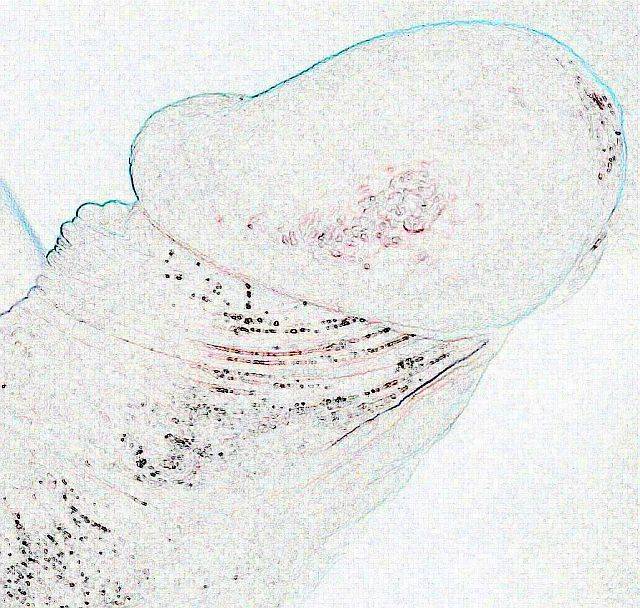 główka pracuje... - ognistyzywiol