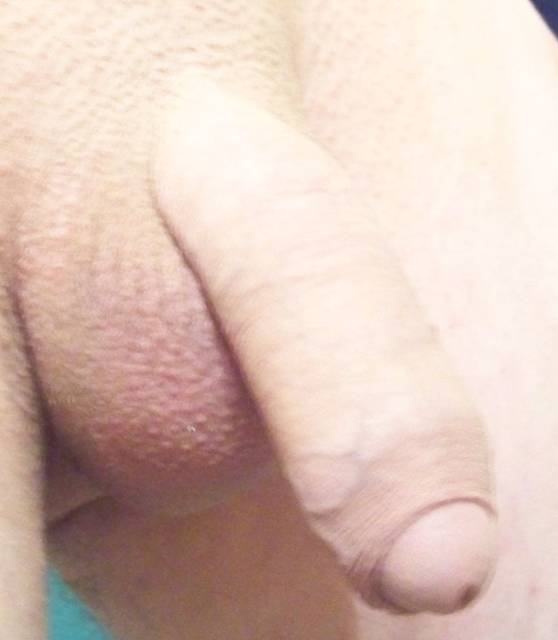 100_0981.JPG - aress81