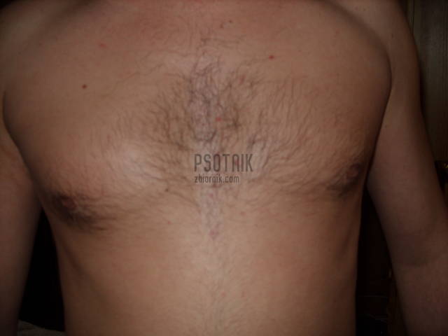 maly byczek - psotnik