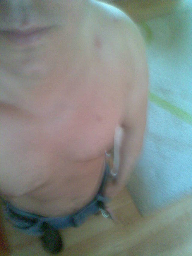 barti17