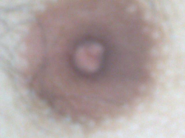 moje brodawki - dmrdm