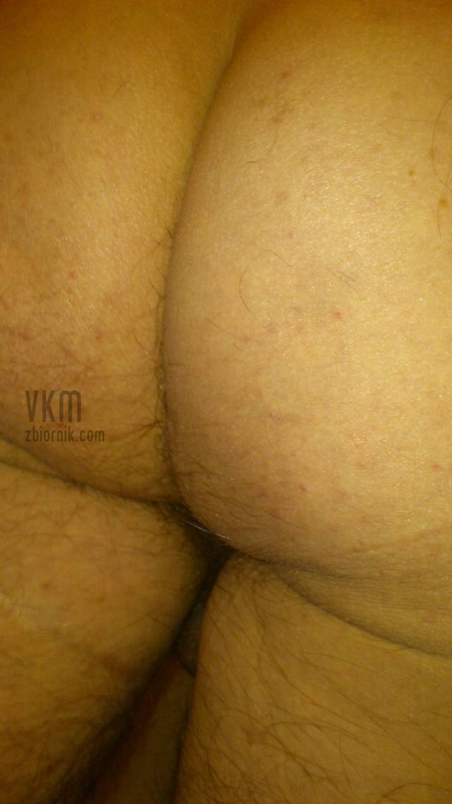 VKM