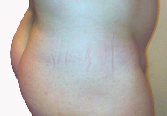 RduFjna2.jpg - bomba19