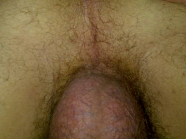 sos31