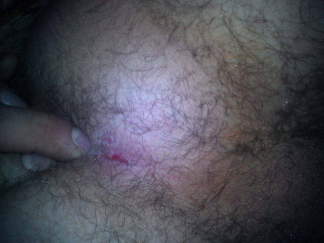 paluszek w tylku - wlocekbitv27