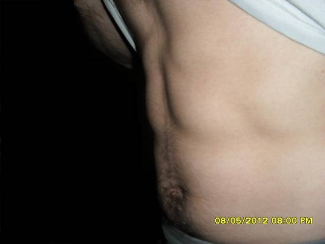 moje zanikajace miesnie;] - 3666