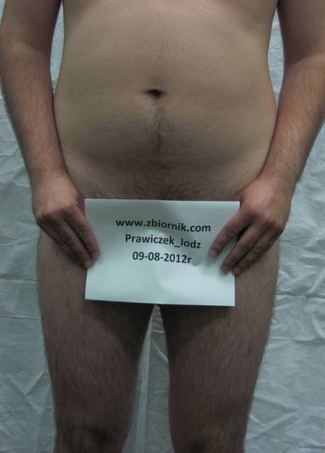 IMG_3928.JPG - Prawiczek_lodz