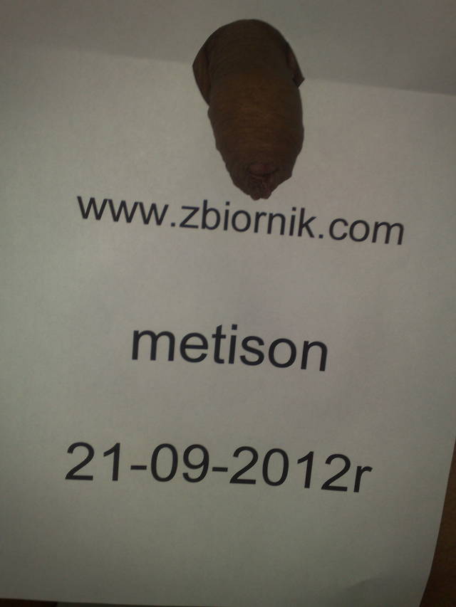 metison