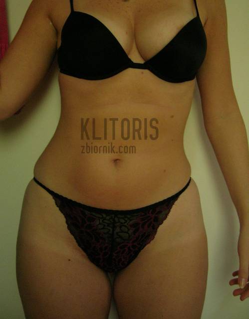 DSCN4425.JPG - klitoris