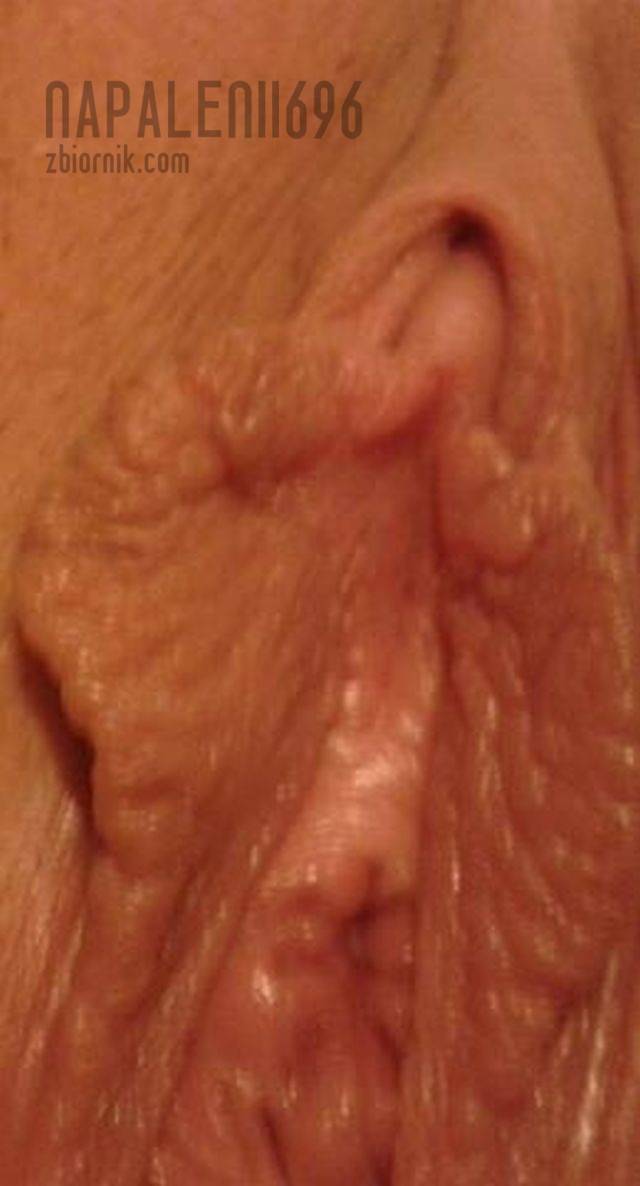 napalenii696