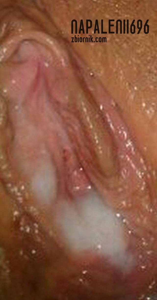 napalenii696