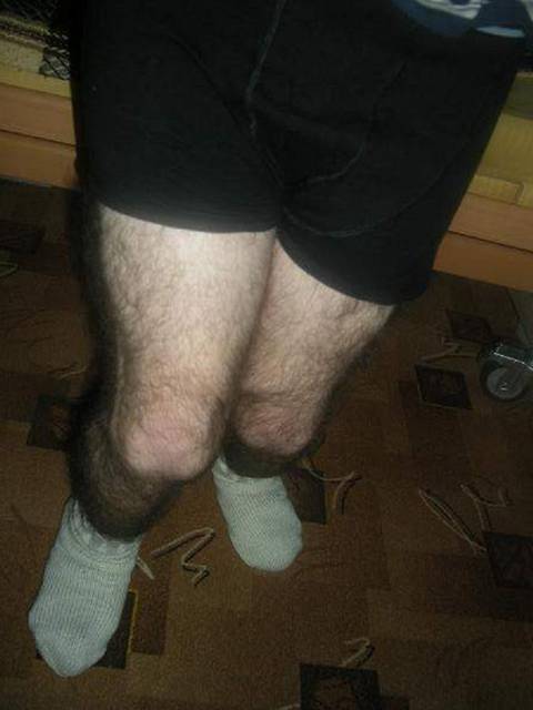 nogiii.JPG - SuwalczaninPasywnyNaWozku