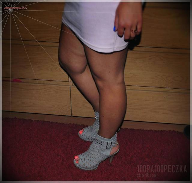 Nogi#26 - 100pa100peczka