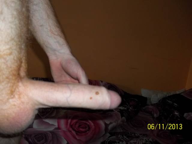 100_0361.JPG - szakalek81