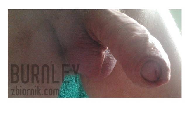 rano to jest jednak przesrane - burnley