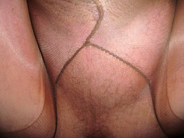 szwy ! - doctorrectus