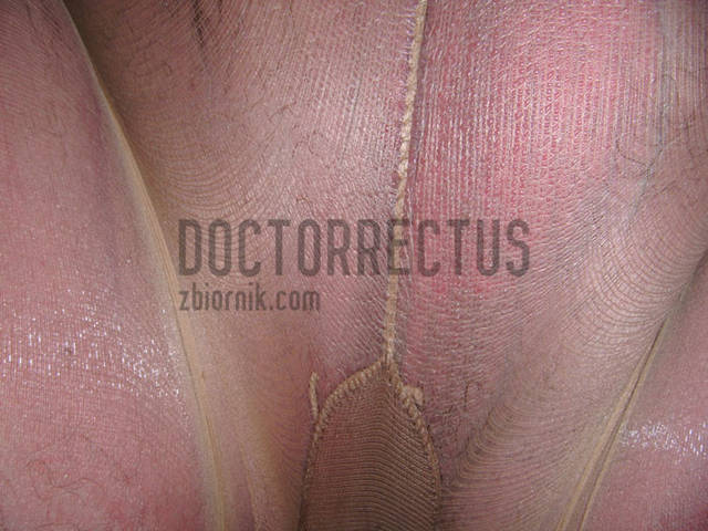 po nocnej wędrówce rowerowej. - doctorrectus