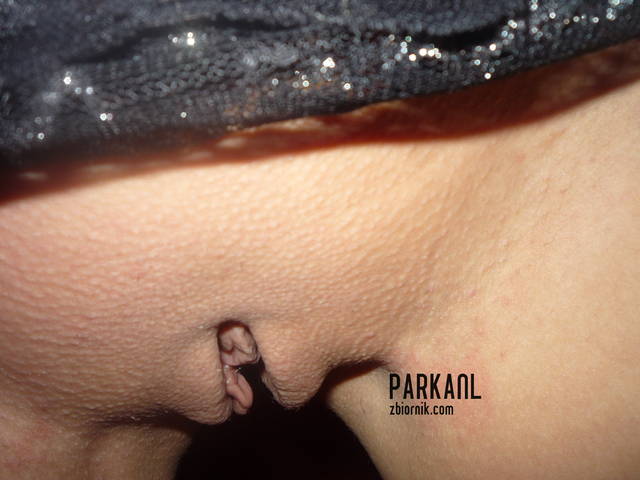 :) - parkanl