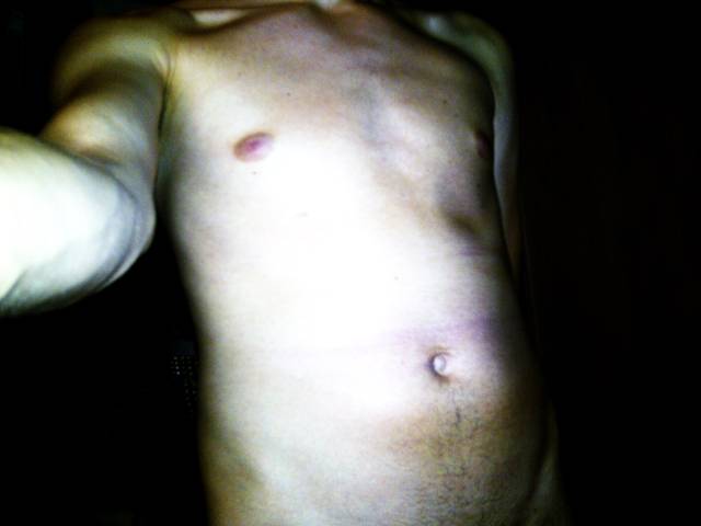 Eripe