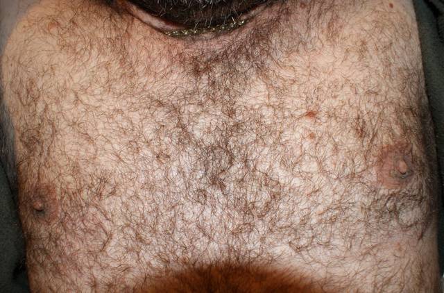 owłosiona klata - motomoto66