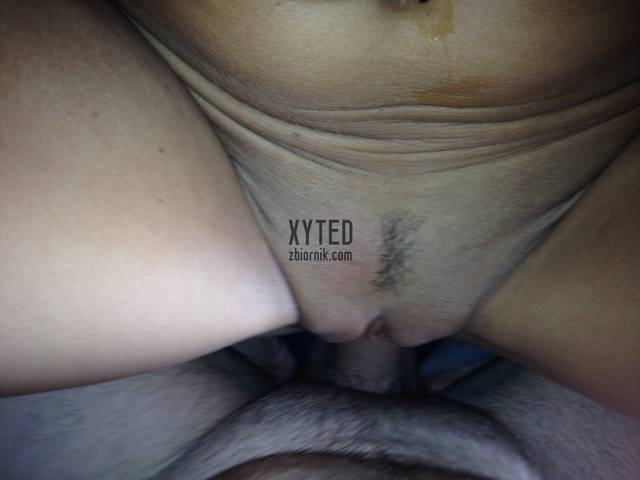 xyted
