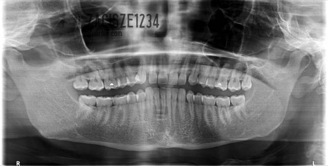 Takie twarzowe :) - Zacisze1234