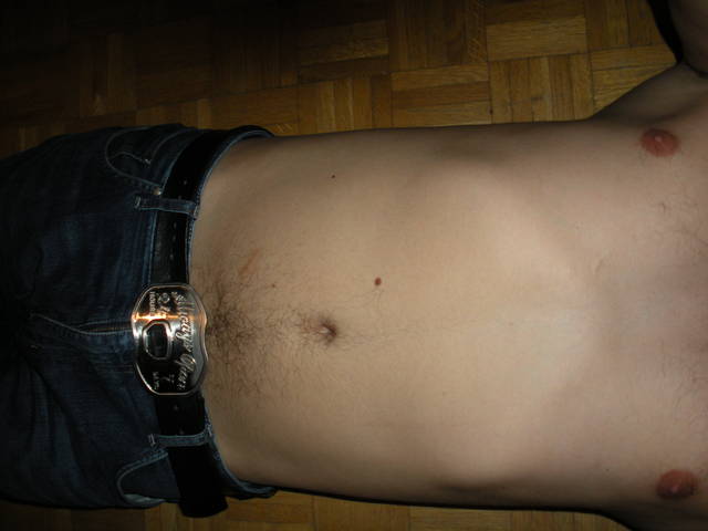 INMIC