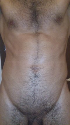 My body
