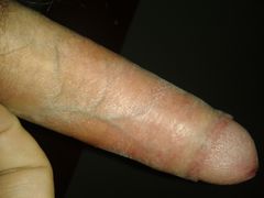 Głowa do góry.....