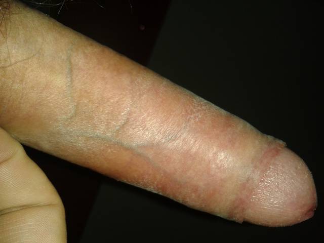 Głowa do góry..... - prompter