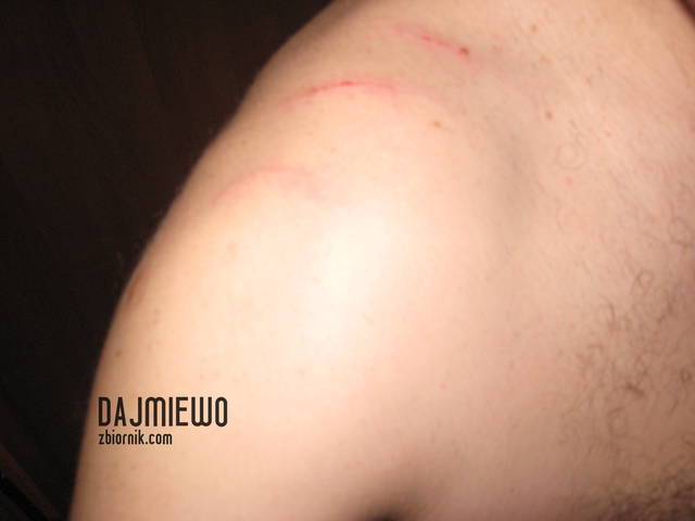 jej pazurki - dajmiewo