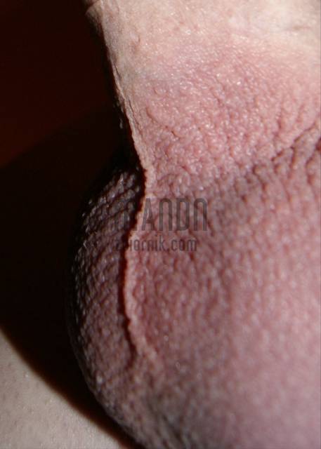 Cudowne uczucie po masażu... B-) - MandN