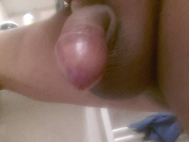 20140815_175429.jpg - Sprocko