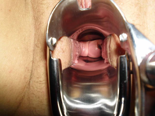 DSCI0051.JPG - lata70