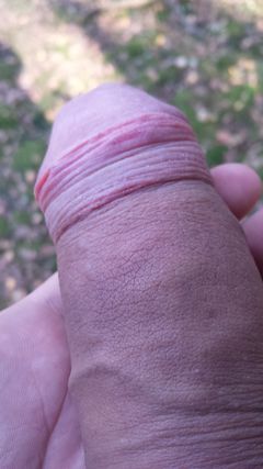 mały śpi w lesie :)