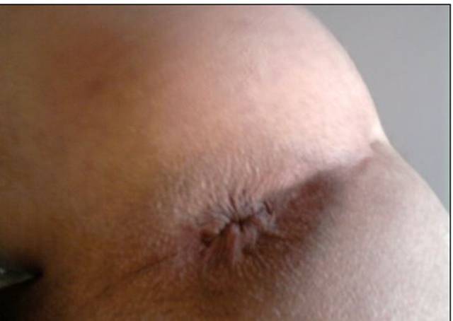 Dupka pasywa - vestis1987