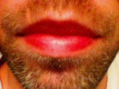 MyRedLIPS.jpg