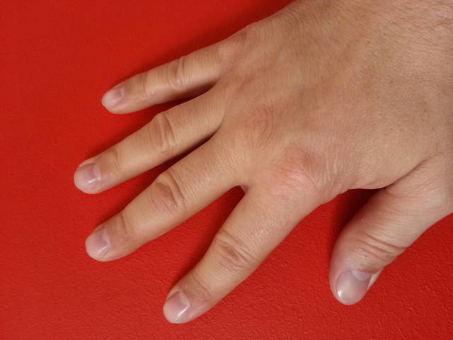 20150319_104305.jpg - NESTOREOLIWIER