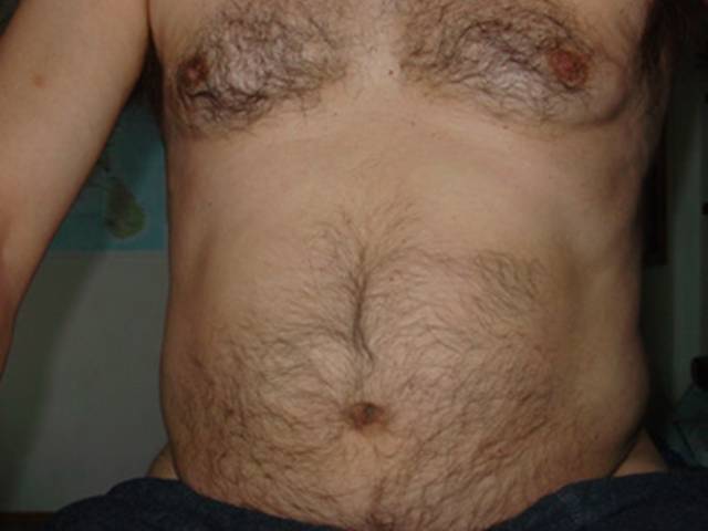 zzz (1).jpg - gazmor