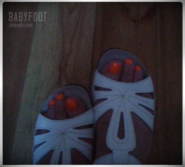09 fotka - Babyfoot