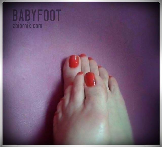 czerwone lizaczki - Babyfoot
