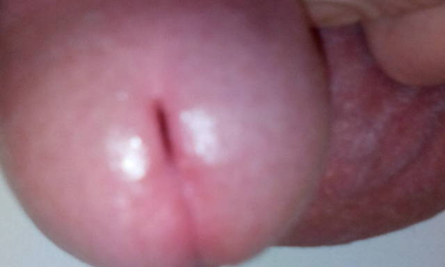 IMG_20151109_210727.jpg - robercu