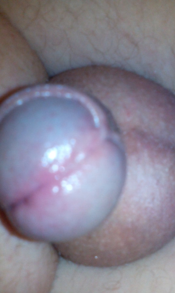 IMG_20151203_073030.jpg - robercu