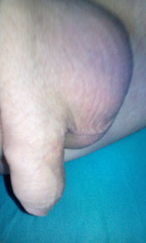 IMG_20151228_112738.jpg - robercu