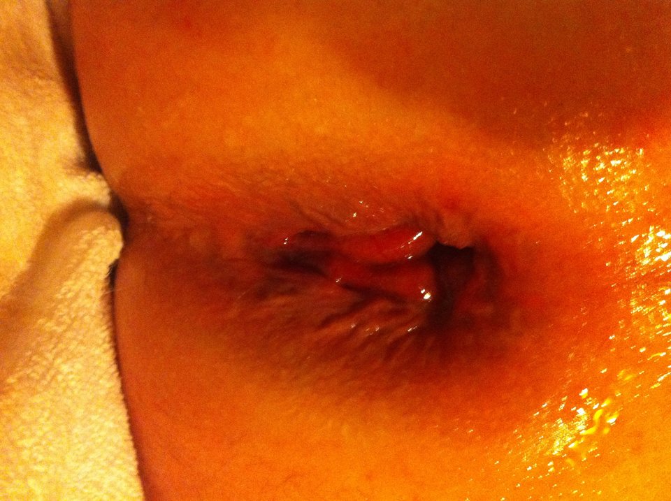 Aż dupa spuchła  - lennyy