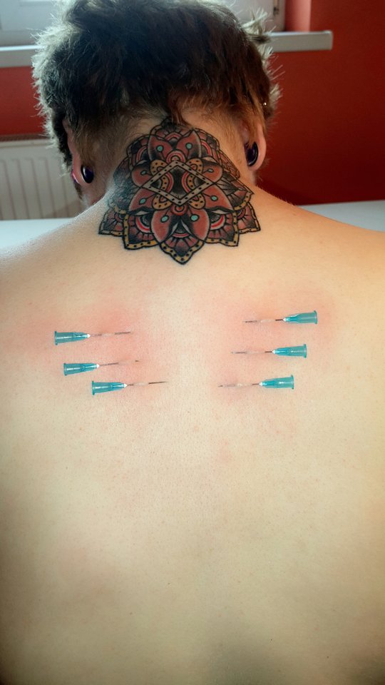 Czasami bawimy się ostrymi narzędziami :) - BezNickowcy